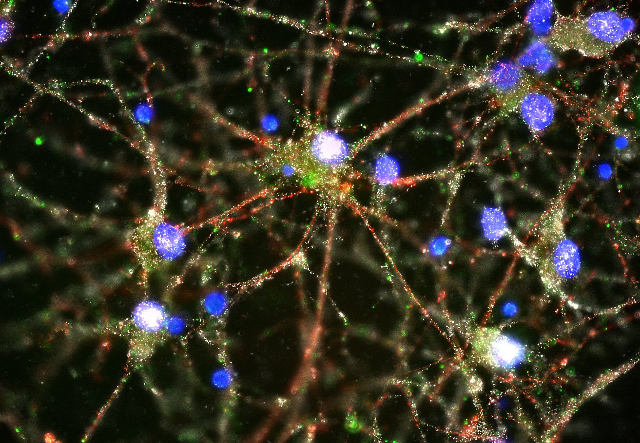 Imaging studies showed C4